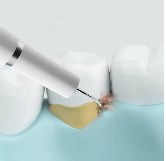 Прибор для удаления зубного камня Xiaomi Dr.Bei Ultrasonic Dental Cleaner YC2 белый